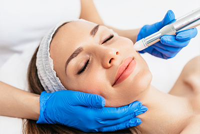 Microneedling